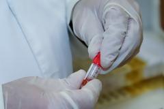 Reuters: Ξεπερνούν τους 50.000 οι νεκροί από τη νόσο στη Βρετανία