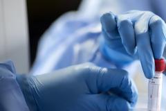 Αισιόδοξα νέα: Μια «ανάσα» πριν τη θεραπεία αντισωμάτων για τον κοροναϊό