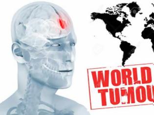 Φωτογραφία για Παγκόσμια Ημέρα κατά των Εγκεφαλικών Όγκων World Brain Tumor Day