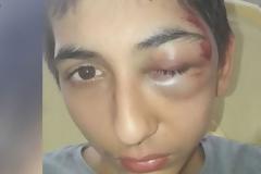 Γαλλία: Σάλος για υπόθεση «ζαρντινιέρα» με 14χρονο Ρομά