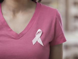 Φωτογραφία για Νόσος Paget καρκίνος μαστού που μιμείται την μαστίτιδα