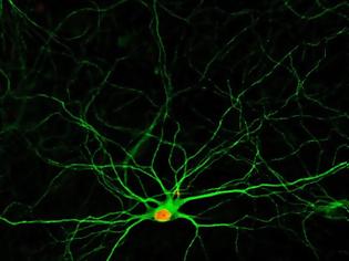 Φωτογραφία για «Χάπι» θα αναγεννά νευρώνες στον εγκέφαλο. Ελπίδα για ασθενείς με Αλτσχάιμερ, εγκεφαλικό