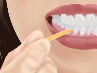 Φωτογραφία για Είναι καλό να καθαρίζουμε τα δόντια μας, με οδοντογλυφίδες;