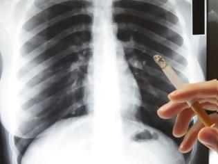 Φωτογραφία για Σε πόσο καιρό θα καθαρίσουν οι πνεύμονες, αν κόψετε το κάπνισμα;