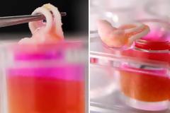3D printing οστών απευθείας στο σώμα του ασθενή