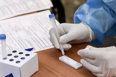 Δεν θα γίνονται στα φαρμακεία τα rapid test