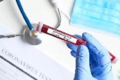 Self test: Τα 18 SOS για εργαζόμενους και εργοδότες - Τι ισχύει από Δευτέρα