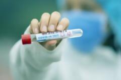 Προμήθεια των δωρεάν self tests από τους εργαζόμενους ιδιωτικού τομέα  σε επιχειρηματικές δραστηριότητες κλάδων που εμπίπτουν στην σχετική ΚΥΑ