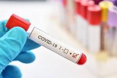 Επιβεβαιωμένο κρούσμα covid 19 σε εργαζόμενο της ΔΕΥΑΑ.