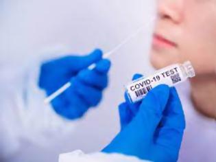 Φωτογραφία για Πάτρα: Καθηγητές του Πανεπιστημίου πέτυχαν μείωση ιικού φορτίου σε ασθενείς με κορονοϊό μέσα σε λίγες ώρες