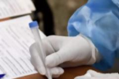 ΕΝΗΜΕΡΩΤΙΚΟ ΕΝΤΥΠΟ ΓΙΑ ΤΗΝ ΔΙΑΘΕΣΗ SELF TESTS -ΔΙΕΥΚΡΙΝΙΣΕΙΣ ΥΠ. ΕΡΓΑΣΙΑΣ ΓΙΑ ΤΑ TESTS ΣΤΟΝ ΙΔΙΩΤΙΚΟ ΤΟΜΕΑ