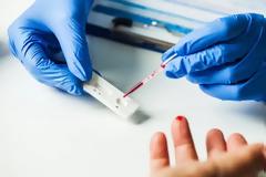 Rapid tests με στόχο την ανίχνευση ασθενειών με όχημα τη νανοτεχνολογία-New rapid test in Greece