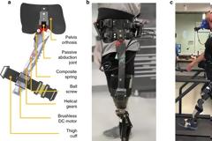 Ένας νέος «έξυπνος» εξωσκελετός βελτιώνει σημαντικά τη βάδιση των ασθενών με ακρωτηριασμό πάνω από το γόνατο