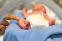 Βραζιλία: Μωρό γεννήθηκε με ουρά 12 εκατοστών
