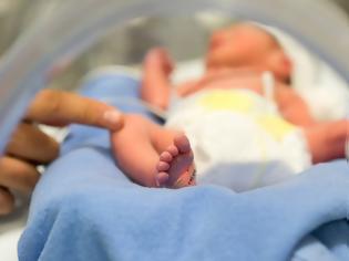 Φωτογραφία για Βραζιλία: Μωρό γεννήθηκε με ουρά 12 εκατοστών