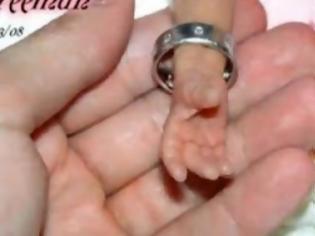Φωτογραφία για VIDEO | H συγκινητική ιστορία της μικρούλας Κάιλι Φρίμαν...