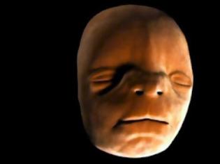 Φωτογραφία για Η διαμόρφωση του προσώπου ενός εμβρύου [video]