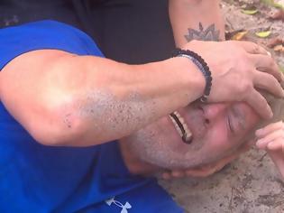 Φωτογραφία για Survivor: Κόντεψε να του βγει το μάτι μετά από τσίμπημα σφήκας...