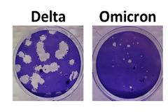 Έως και 99% λιγότερους θανάτους προκαλεί η Omicron σε σχέση με τη Delta σύμφωνα με νέα έρευνα
