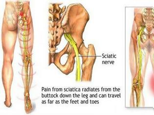 Φωτογραφία για Κάντε αυτές τις 2 ασκήσεις, ξεκλειδώστε το ισχιακό νεύρο και πείτε αντίο στο πόνο σε μόλις 2 λεπτά!!!