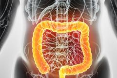 ΠΦΣ: Ανάρτηση των δικαιωμάτων αποζημίωσης για τη δράση πρόληψης του καρκίνου του παχέος εντέρου