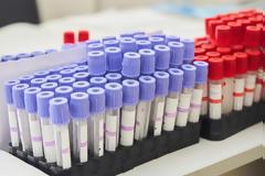 Διαγνωστικές εξετάσεις: Σε ΦΕΚ νέες αυξήσεις για τους ασφαλισμένους - Πόσο παραπάνω θα πληρώνουν