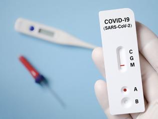 Φωτογραφία για «Παράταση των άυλων γνωματεύσεων στο ηλεκτρονικό σύστημα του edapy & της διενέργειας των rapid tests από τα ιδιωτικά φαρμακεία»