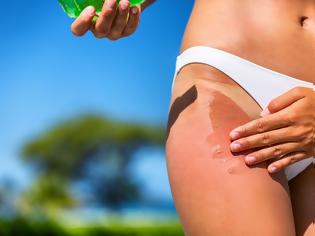 Φωτογραφία για 4 πολύτιμα οφέλη της Αλόης για την υγεία μας