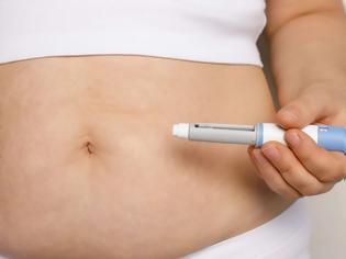 Φωτογραφία για Τα φάρμακα για αδυνάτισμα μειώνουν την κατάθλιψη έως 44%