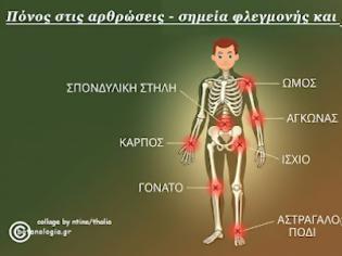 Φωτογραφία για Ο “άξονας εντέρου-άρθρωσης” συνδέει την υγεία του εντερικού μικροβιώματος με την αρθρική φλεγμονή.