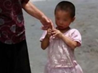 Φωτογραφία για Συγκλονιστική εικόνα: Κοριτσάκι χόμπιτ στην Κίνα