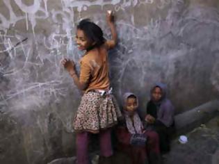 Φωτογραφία για Ένα εκατομμύριο παιδιά κινδυνεύουν από σοβαρό υποσιτισμό στην Υεμένη