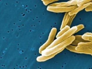 Φωτογραφία για Πέντε παιδιά βρέθηκαν θετικά στη φυματίωση