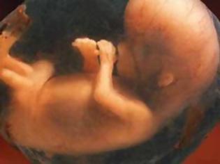 Φωτογραφία για Βρέθηκαν 248 ανθρώπινα έμβρυα εγκαταλελειμμένα σε δάσος