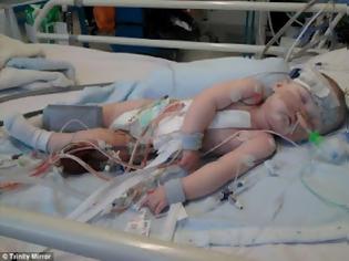 Φωτογραφία για Εικόνα που ραγίζει καρδιές: Είναι 15 μηνών και χρειάζεται μόσχευμα για να ζήσει!