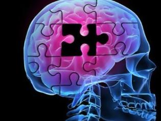 Φωτογραφία για Έλληνες ανακάλυψαν εργαλείο πρώιμης διάγνωσης Αλτσχάιμερ