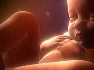 Φωτογραφία για Διεθνής οργάνωση σπέρνει τον θάνατο σε αγέννητα μωρά