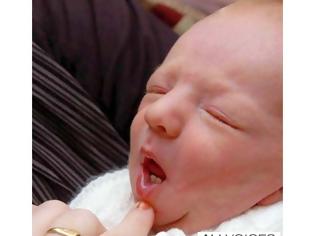 Φωτογραφία για ΔΕΙΤΕ: Νεογέννητο μωρό με… δόντια!