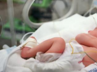 Φωτογραφία για Κοριτσάκι στην Κύπρο γεννήθηκε με 24 δάχτυλα - Για αμέλεια κατηγορούνται οι ιατροί