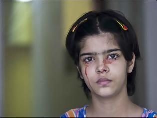 Φωτογραφία για VIDEO: Κλαίει με δάκρυα από αίμα