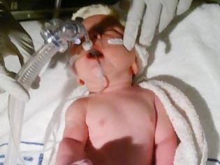 Φωτογραφία για Κοριτσάκι γεννήθηκε με την καρδιά στη ΔΕΞΙΑ πλευρά