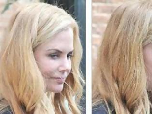 Φωτογραφία για «Πάγωσε» από τα botox το πρόσωπο της Nicole Kidman!