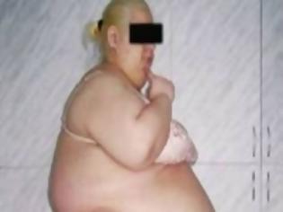 Φωτογραφία για ΣΟΚΑΡΙΣΤΙΚΗ ΦΩΤΟ: Αφαίρεσαν λίπος 57 κιλών από την κοιλιά μιας Ρωσίδας