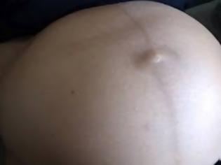 Φωτογραφία για Βίντεο: Δείτε πώς αλλάζει μορφή η κοιλιά μιας εγκύου