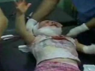Φωτογραφία για Συρία: Συγκλονιστικό βίντεο, πατέρας προσπαθεί να σώσει το παιδί του