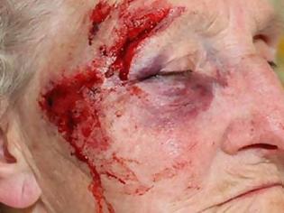 Φωτογραφία για Νύχτα τρόμου για ηλικιωμένη γυναίκα στο Αιγάλεω..Την σάπισαν στο ξύλο και την λήστεψαν μέσα στο σπίτι της..