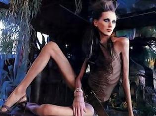 Φωτογραφία για Topmodel αποκαλύπτει τις απίστευτες (έως τρομακτικές) μεθόδους που ακολουθούν τα μοντέλα για να αδυνατίσουν!