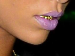 Φωτογραφία για QUIZ: Ποιά γνωστή τραγουδίστρια εμφανίστηκε με χρυσά δόντια;