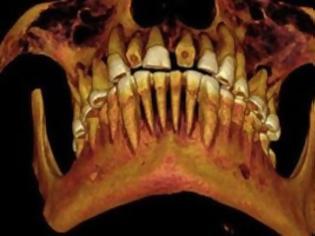 Φωτογραφία για Βρέθηκε μούμια γεμάτη τερηδόνα! - Το χειρότερο περιστατικό στην ιστορία της οδοντιατρικής