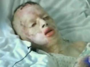 Φωτογραφία για ΦΡΙΚΗ - ΤΟΝ ΒΙΑΣΕ ΚΑΙ ΓΙΑ ΝΑ ΤΟΝ ΚΑΝΕΙ ΣΩΠΑΣΕΙ,ΤΟΝ ΕΔΕΣΕ ΣΤΟ ΔΕΝΤΡΟ ΚΑΙ ΤΟΥ ΕΒΑΛΕ ΦΩΤΙΑ [ΦΩΤΟ+ΒΙΝΤΕΟ]